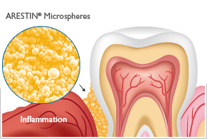 Periodontal Treatment